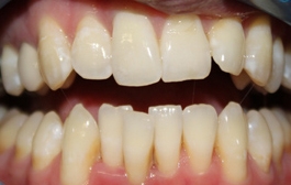 Smile Gallery - Church Road Dental and Cosmetic