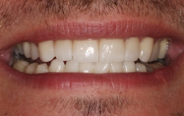 Smile Gallery - Church Road Dental and Cosmetic