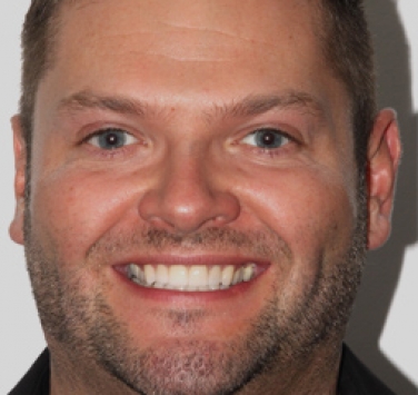 Smile Gallery - Church Road Dental and Cosmetic