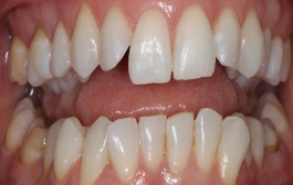 Smile Gallery - Church Road Dental and Cosmetic