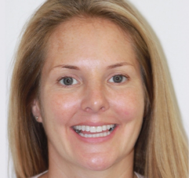 Smile Gallery - Church Road Dental and Cosmetic