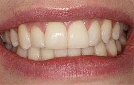 Smile Gallery - Church Road Dental and Cosmetic