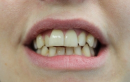 Smile Gallery - Church Road Dental and Cosmetic