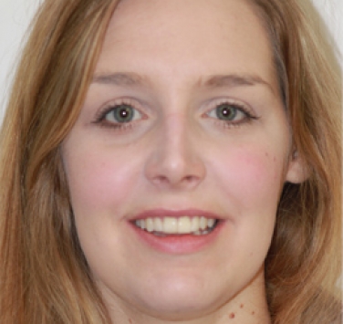 Smile Gallery - Church Road Dental and Cosmetic