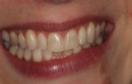Smile Gallery - Church Road Dental and Cosmetic
