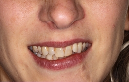 Smile Gallery - Church Road Dental and Cosmetic