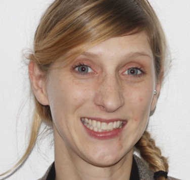 Smile Gallery - Church Road Dental and Cosmetic