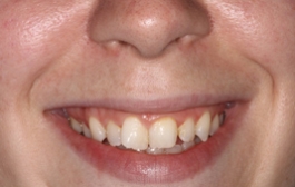 Smile Gallery - Church Road Dental and Cosmetic