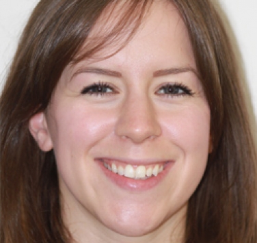 Smile Gallery - Church Road Dental and Cosmetic
