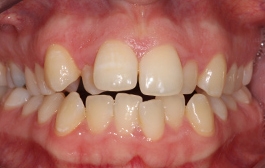 Smile Gallery - Church Road Dental and Cosmetic