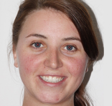 Smile Gallery - Church Road Dental and Cosmetic