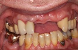 Smile Gallery - Church Road Dental and Cosmetic