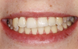 Smile Gallery - Church Road Dental and Cosmetic