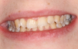 Smile Gallery - Church Road Dental and Cosmetic