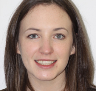 Smile Gallery - Church Road Dental and Cosmetic