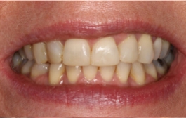 Smile Gallery - Church Road Dental and Cosmetic