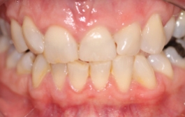 Smile Gallery - Church Road Dental and Cosmetic