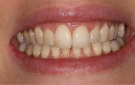 Smile Gallery - Church Road Dental and Cosmetic
