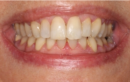Smile Gallery - Church Road Dental and Cosmetic