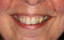 Smile Gallery - Church Road Dental and Cosmetic