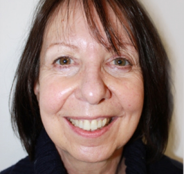 Smile Gallery - Church Road Dental and Cosmetic