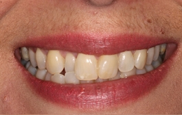 Smile Gallery - Church Road Dental and Cosmetic