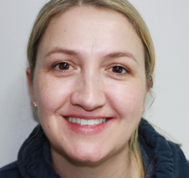 Smile Gallery - Church Road Dental and Cosmetic