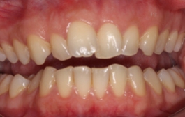 Smile Gallery - Church Road Dental and Cosmetic