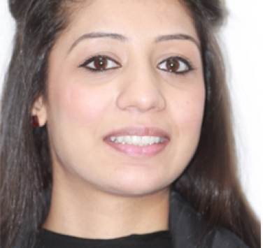 Smile Gallery - Church Road Dental and Cosmetic