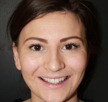 Smile Gallery - Church Road Dental and Cosmetic