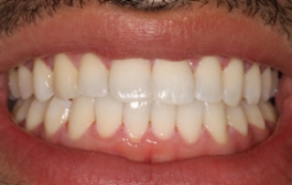 Smile Gallery - Church Road Dental and Cosmetic