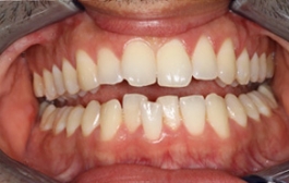 Smile Gallery - Church Road Dental and Cosmetic