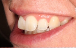 Smile Gallery - Church Road Dental and Cosmetic