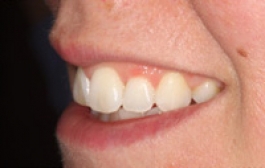 Smile Gallery - Church Road Dental and Cosmetic