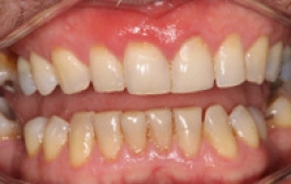 Smile Gallery - Church Road Dental and Cosmetic