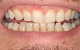 Smile Gallery - Church Road Dental and Cosmetic