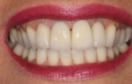 Smile Gallery - Church Road Dental and Cosmetic
