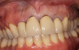 Smile Gallery - Church Road Dental and Cosmetic