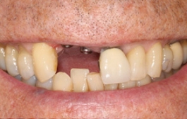 Smile Gallery - Church Road Dental and Cosmetic