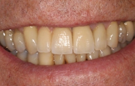 Smile Gallery - Church Road Dental and Cosmetic