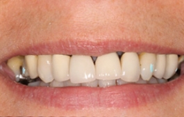 Smile Gallery - Church Road Dental and Cosmetic