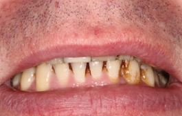 Smile Gallery - Church Road Dental and Cosmetic