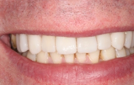 Smile Gallery - Church Road Dental and Cosmetic