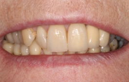 Smile Gallery - Church Road Dental and Cosmetic