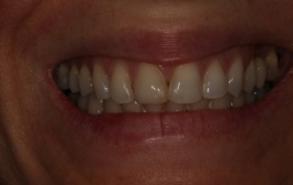 Smile Gallery - Church Road Dental and Cosmetic