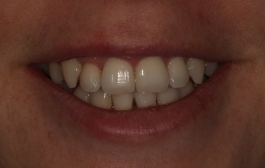 Smile Gallery - Church Road Dental and Cosmetic