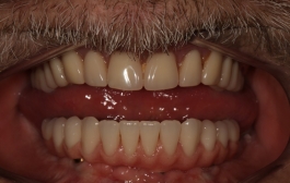 Smile Gallery - Church Road Dental and Cosmetic