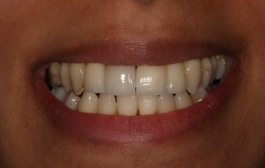 Smile Gallery - Church Road Dental and Cosmetic