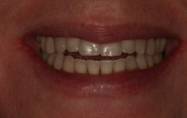 Smile Gallery - Church Road Dental and Cosmetic