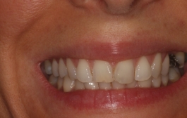 Smile Gallery - Church Road Dental and Cosmetic